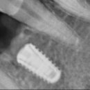 나무가있는치과의원 이미지