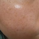 만세대약국 | 도미나크림 가격 사용법 효과 후기