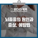 미리 알면 대비할 수 있다! 뇌졸중의 원인과 증상 , 예방법 이미지