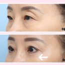 초이성형외과의원 이미지