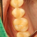 이건치과기공소 이미지