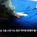 허리디스크와 강직척추염 이미지