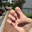 울들병원 | 허리의 중요성 2(허리디스크 파열, 신경 성형술 후 입원 후기)