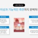 ID기공소 이미지