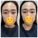 금천동 피부관리 신기한 윤곽관리 슈아브 에스테틱