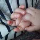 김동억 | 칠곡영유아검진, 손에 상처나서 병원간 후기(김동억소아과영유아검진, 로즈마리병원)