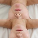소래로 | 시흥 은계 피부관리 소래에스테틱 신부관리 후기