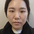 티엔뷰티샵 | 신중동 등관리 봄엔뷰티 얼굴수기+미니등관리 만족 후기