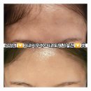 지우개 | 삼성동피부과 피코토닝 하러 갔다가 || 피코지우개 하게 된 후기 (잡티 많은 얼굴 현실)