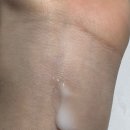 광민유통 | 피부 SOS! 아크리프 연고 써본 솔직 후기 (레티노이드, 레티놀)