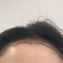 권헤어라인