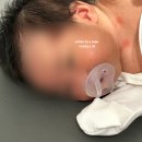 우량아약국 | BCG경피용(+1차영유아검진), 헥사심, 폐구균, 로타바이러스, RSV 접종 후기