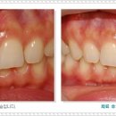 세라치과기공소 이미지