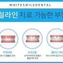 청주으뜸치과 이미지