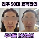 더안심부동산인테리어 | [진주더안뷰티] 진주 50대 시어머니 윤곽관리 1회차 후기! 중안면부가 작아지다니!