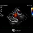 보성통증동물병원 | 대전 신경외과 동물병원 통증 없는 강아지 디스크 수술 후기 MRI 촬영