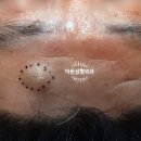 아문성형외과의원 이미지