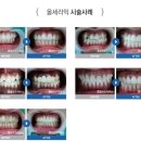 올크라운
