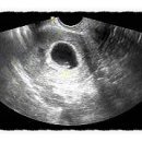 꽃순이PC 이미지