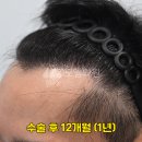 모엠의원 Daum카페