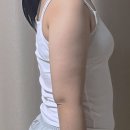 아르고 | 아르고나 위고비 효과 부작용 후기 한달 -8kg