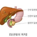 담관암 원인 예방 이미지