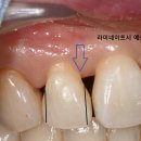 둔산치과기공소 이미지