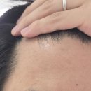 리치엠 - 금천구 가산디지털2로 14 | 모발 성장기에 집중한 탈모 관리, 메타웰 리치엠 핵심 성분 완벽 분석 후기!