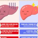 지방간에 좋은 음식 지방간 초기 증상 간수치 이미지