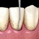 하양탑치과 이미지