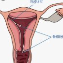 미소담의원 네이버블로그
