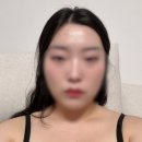 오르세윤의원 | [서울 강남구] 예신관리 추천, 청담동 피부과 쓰리딥 리프팅 솔직후기