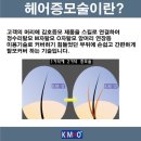 김호증모가발탐나