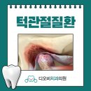 디오비치과의원 네이버블로그
