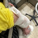 재난음성통보시스템 | 9개월 아기 가와사키병 증상 치료 입원후기