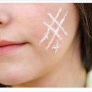 휴먼피부과의원 청라점 이미지