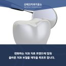 좋은하루치과기공소 네이버블로그