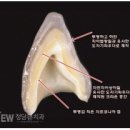 청담치과기공소 이미지