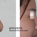 마론성형외과