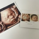 송파미소병원 | 임신 28주 송파고은빛 입체초음파 후기 | 베이비페이스 할인코드