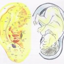 이혈요법 이미지