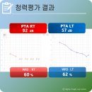 세움재활보장구센터 | 귓속형보청기 2026년 정부지원 보청기 보장구 제도 및 착용/시그니아 인시오 7NX