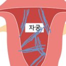 홀리쉿..싸이토텍정..자궁경 후기..인생이 힘들다..