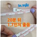 라라체형관리