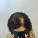 두두스칼프