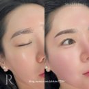 자연스럽게 살아난 눈썹, 춘천눈썹은 로엔숲에서 경험했어요!