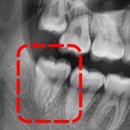 이하루치과의원 이미지
