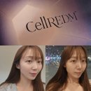 마땡 | 분당서현피부과 셀르디엠 콜라겐 스킨부스터 통증 효과 가격 다이어트 눈밑꺼짐 팔자패임 솔직후기