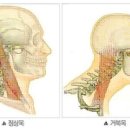 거북목 이미지