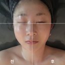 예하에스테틱 | 인천윤곽관리 예하에스테틱 얼굴 리프팅후기